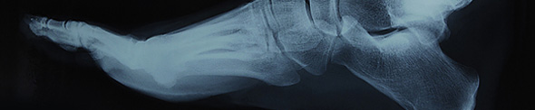 XRay of human foot side view